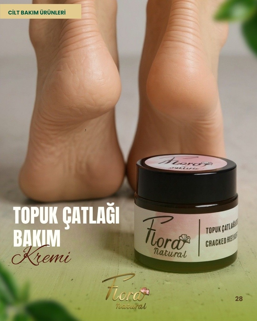 TOPUK ÇATLAĞI KREMİ  